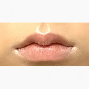 いとうらんクリニック四条烏丸口コミ