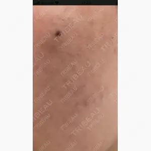 つばめ美容クリニック口コミ