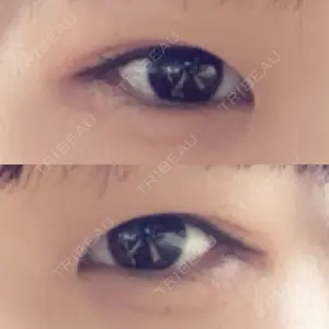 高崎美容クリニック口コミ