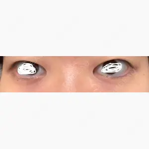 蘇春堂形成外科口コミ