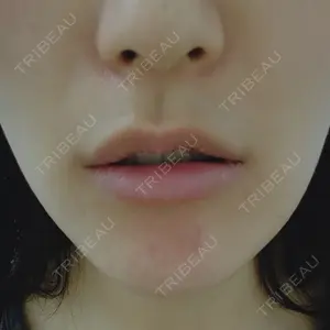 MSC LUNA CLINIC 渋谷院口コミ