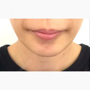 MSC LUNA CLINIC 渋谷院口コミ