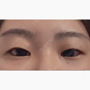 西堀形成外科口コミ