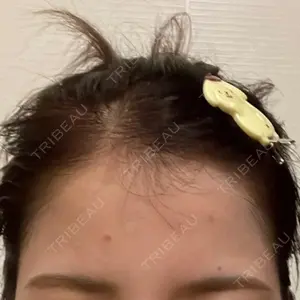 ニュービューティークリニック口コミ