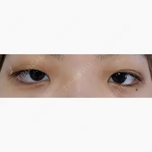 蘇春堂形成外科口コミ