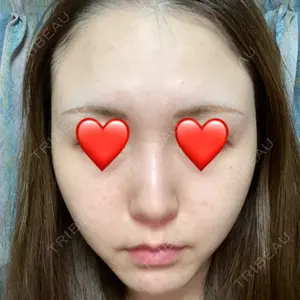 エートップ美容整形外科口コミ