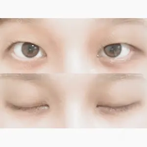 水の森美容クリニック 大阪梅田院口コミ