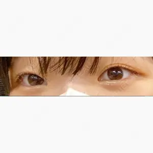 神戸元町ビューティークリニック口コミ