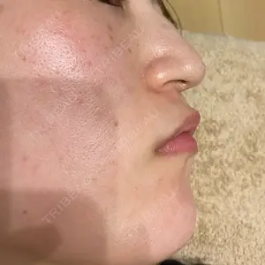 レナータクリニック 立川院口コミ