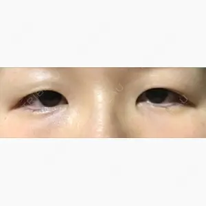 蘇春堂形成外科口コミ