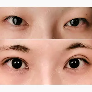 ユウコ形成外科クリニック口コミ