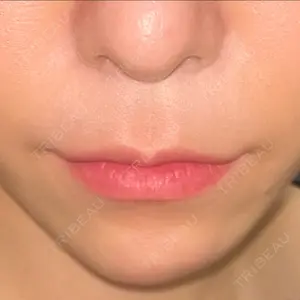 ドクターゴールドマンクリニック 大阪院口コミ