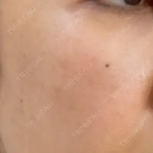 design beauty clinic 梅田本院口コミ