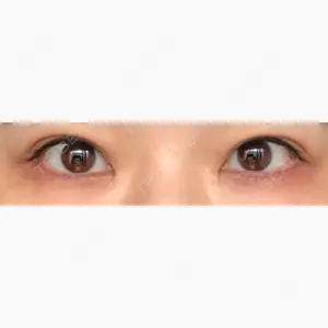 湘南美容クリニック 表参道院口コミ