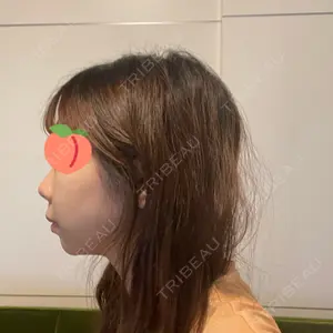 銀座みゆき通り美容外科 大阪梅田院口コミ