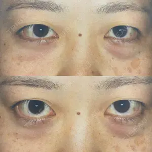 リッツ美容外科 東京院口コミ