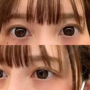 LIGHT CLINIC 【ライトクリニック】 大阪院口コミ