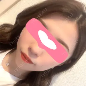 銀座みゆき通り美容外科 大阪梅田院口コミ