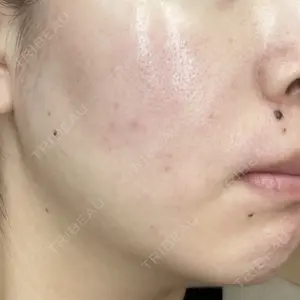 ノリス美容クリニック口コミ