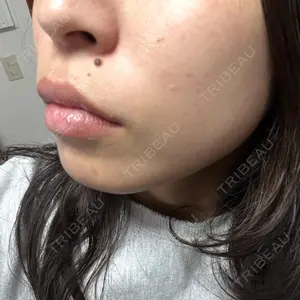 美容皮膚科エルムクリニック 福岡院口コミ