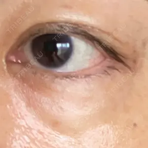おきなわ美容クリニック口コミ