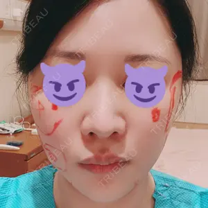 リッツ美容外科 東京院口コミ