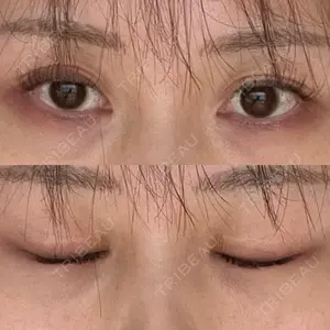 サラ美容外科口コミ