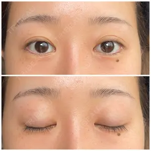 アイーラ美容整形外科口コミ