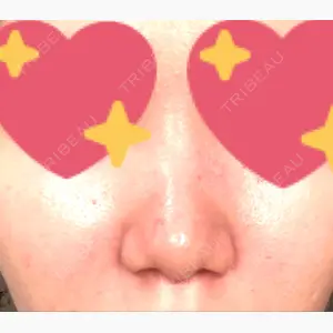 品川スキンクリニック 新潟院口コミ