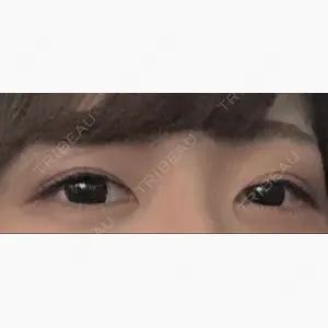 札幌ル・トロワ ビューティクリニックVogue口コミ