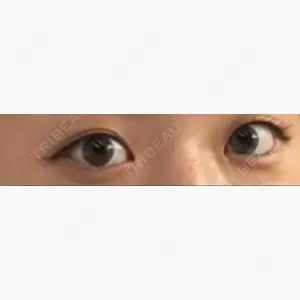 いちのせ形成外科・皮膚科 眼瞼＆フェイスクリニック口コミ