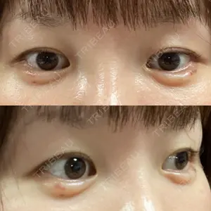 表参道スキンクリニック 表参道院口コミ