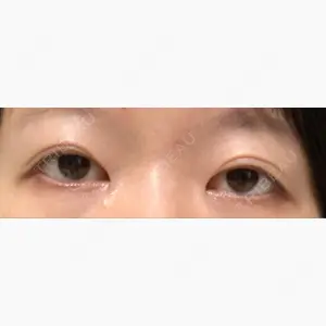 心斎橋コムロ美容外科クリニック口コミ