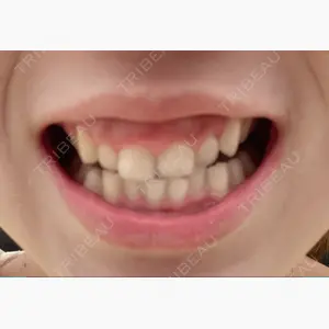 東京銀座A CLINIC デンタル口コミ