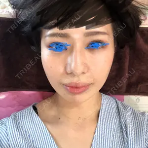 ニューセンス皮膚科クリニック口コミ