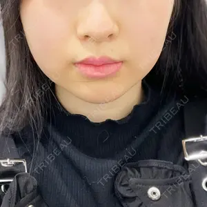 TCB東京中央美容外科 名古屋駅前院口コミ