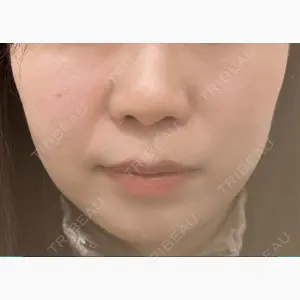 百人町アルファクリニック口コミ