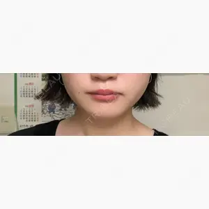 湘南美容クリニック 大宮院口コミ