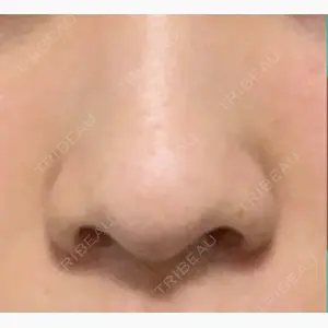 ヴェリテクリニック 銀座院口コミ