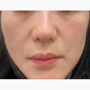 高崎美容クリニック口コミ