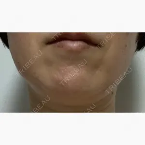 ユウコ形成外科クリニック口コミ