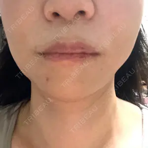 美容皮膚科エルムクリニック 福岡院口コミ