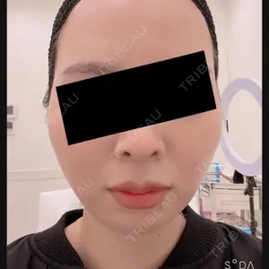 美容皮膚科エルムクリニック 福岡院口コミ