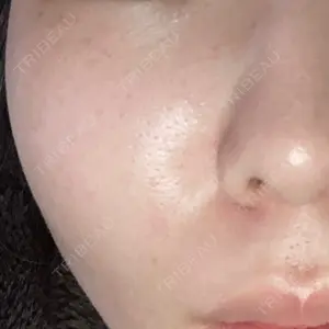 品川スキンクリニック表参道院口コミ