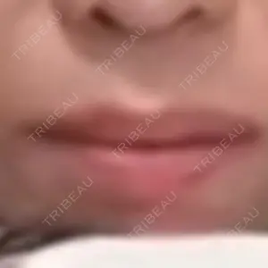 ドクターゴールドマンクリニック 大阪院口コミ