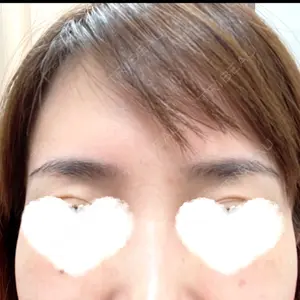 ももスキンケアクリニック口コミ