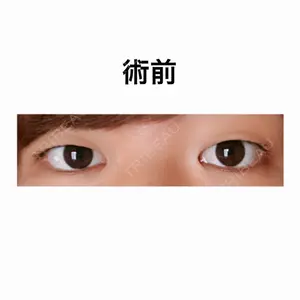 共立美容外科 高崎院口コミ