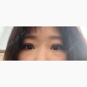 銀座みゆき通り美容外科 大阪梅田院口コミ