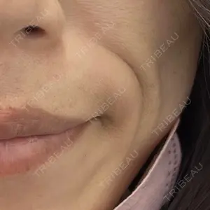 TCB東京中央美容外科 郡山院口コミ