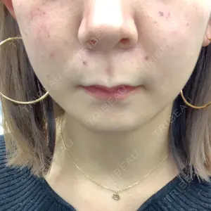 湘南美容クリニック 表参道院口コミ